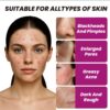 AHA 30% + Glycolic Acid 5%+ BHA 2% Serum