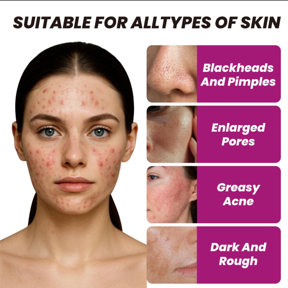AHA 30% + Glycolic Acid 5%+ BHA 2% Serum - 图片 5