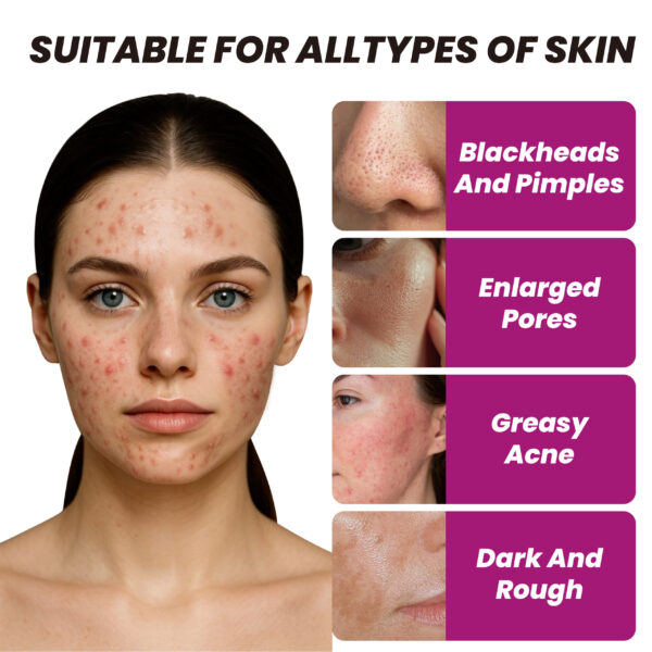 AHA 30% Face Serum