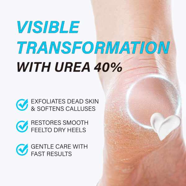 Foot Cream